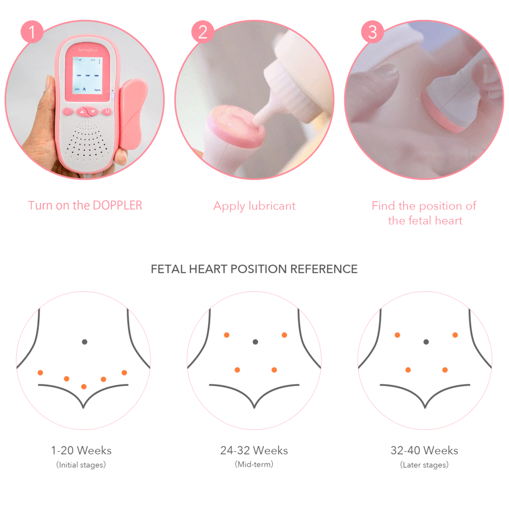 Lifecare Baby Fetal Doppler Monitoring